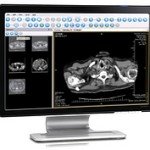 Visualizar Estudios RX